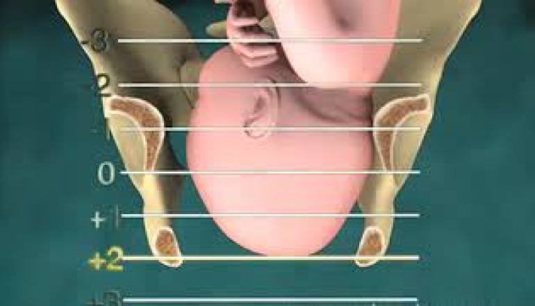 Childbirth Stations of Presentation | Pregnant Life