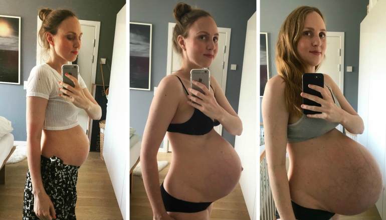 What 3 Kids Growing in One Belly Does to Your Body