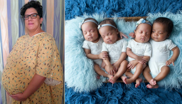 Cancer Survivor Has Quadruplets After Thinking She'd Never Get Pregnant