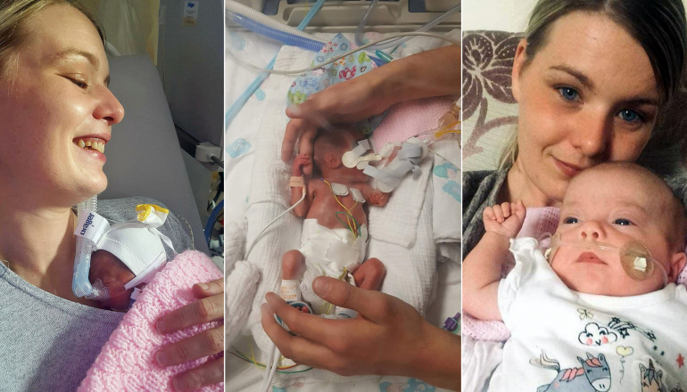 The Touching Moment a Mom Cuddles Her Premature Baby for the First Time