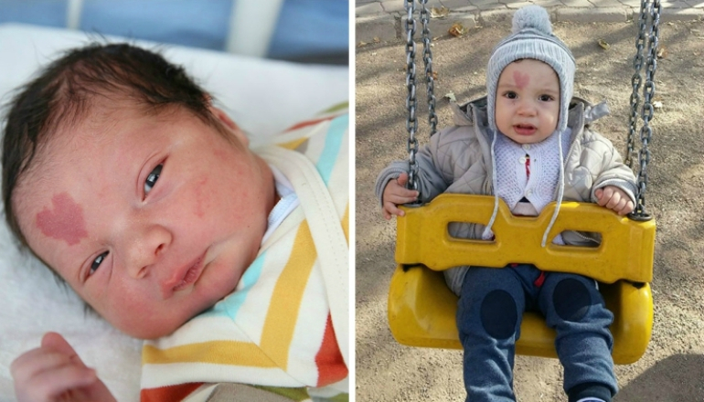 Love Baby: Baby Born With A Heart Shaped Birthmark