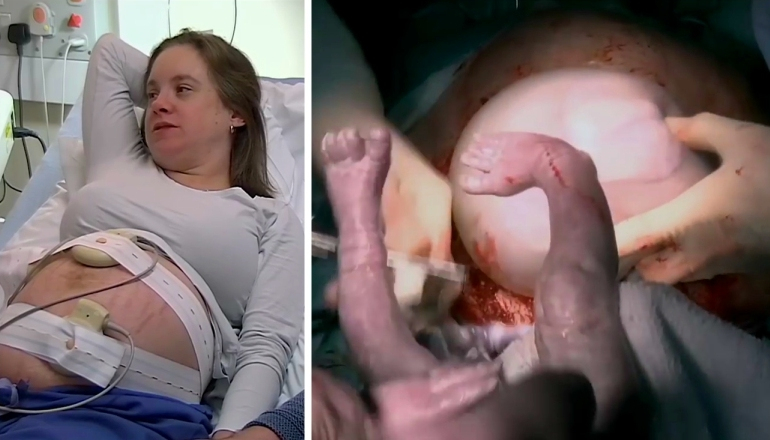 Giving Birth to Twins