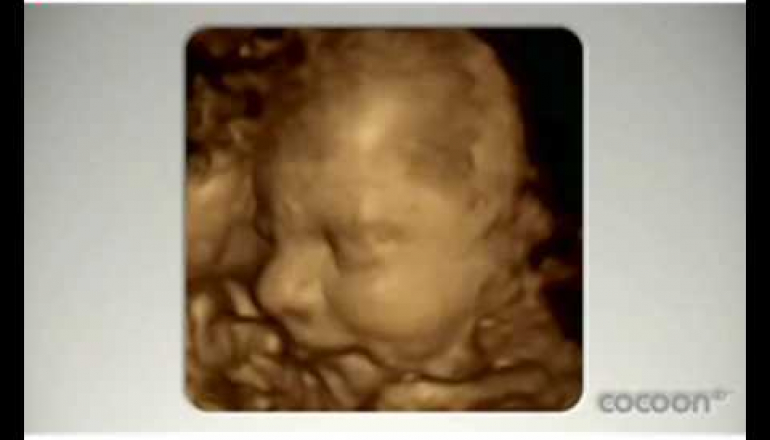 3D/4D baby scan - Anna's Pregnancy Diary: Week 28