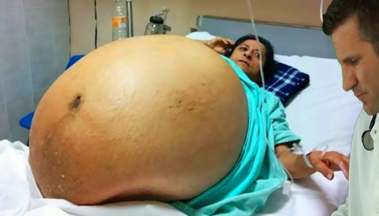 Strangest Pregnancy Conditions