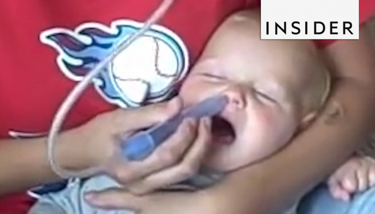 Device Sucks Snot Out Of Baby's Nose