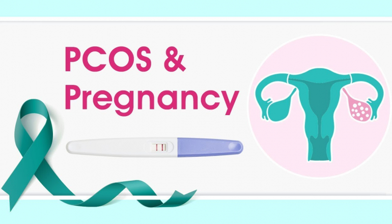 PCOS and Pregnancy