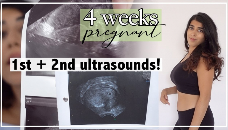 4 Weeks Pregnant 