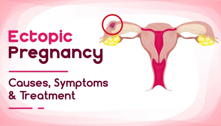 Ectopic Pregnancy - Reasons, Symptoms and Treatment