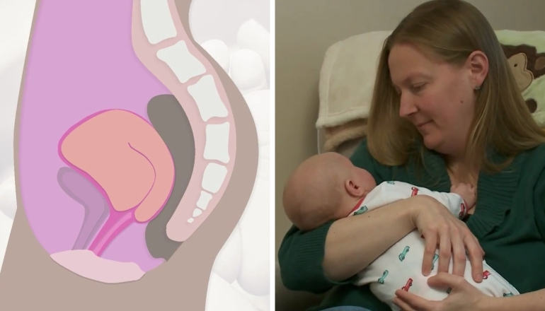 Postpartum Care: Changes in Your Body After Delivery | Pregnant Life