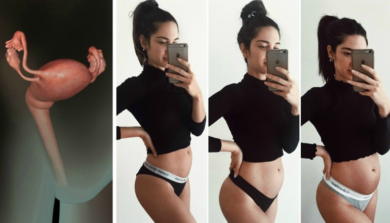 Smaller Baby Bump Due to Backwards Uterus?