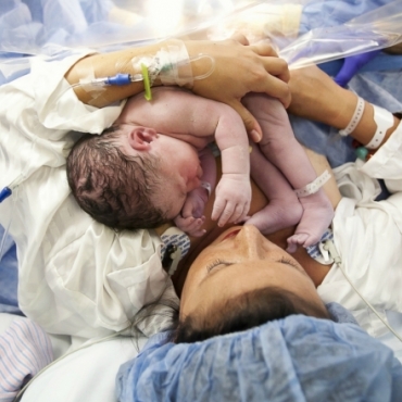 4 Steps to Prepare for Having a Gentle Cesarean