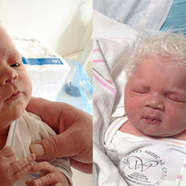 Baby Born With Full Head Of White Hair With Nicknamed  “Prince Charming”