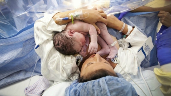 4 Steps to Prepare for Having a Gentle Cesarean