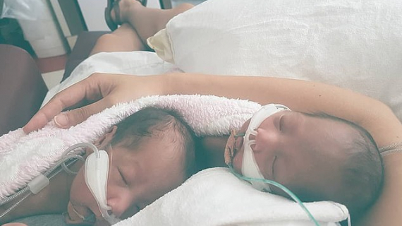 Mother, 29, Who Gave Birth To Very Premature Twins Shares A Heartwarming Photo Of The Separated Siblings 'Hugging' Each Other When Reunited For The First Time