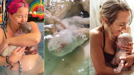 Magical Membranes: 12 Rare Photos of Babies Born in the Amniotic Sac