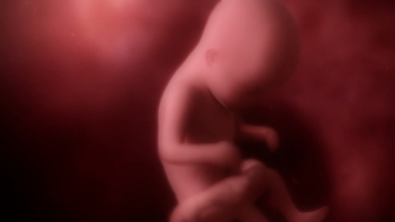 Pregnancy Week by Week: 17 Weeks Pregnant