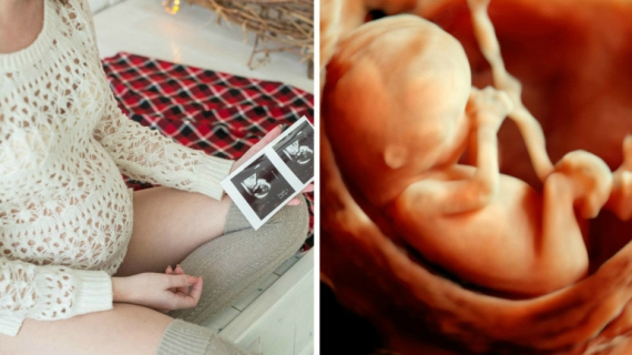 19 Pregnancy Myths Hint at Your Baby's Gender