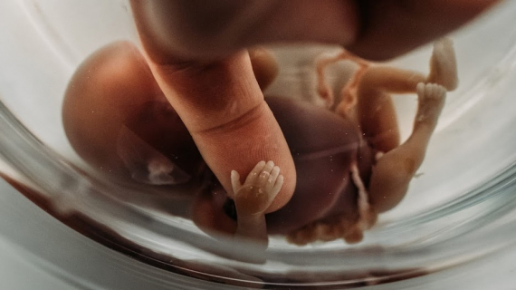 20 Raw Birth Photos That Capture The Beauty And Power Of Delivery 20 Raw Birth Photos That Capture The Beauty And Power Of Delivery