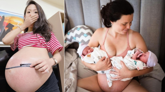 20 Wonderful and Wacky Facts About Twins