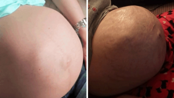 20 Creepy Pregnancy GIFs You Can’t Unsee 20 Creepy Pregnancy GIFs You Can’t Unsee