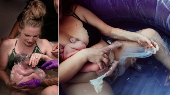 En Caul Births: 25 Rare Photos of Babies Born in the Amniotic Sac
