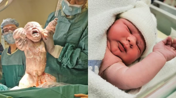 27-Year-Old Mom Gave Birth To A Baby Boy So Big That It Took “Two People To Lift Him Out”