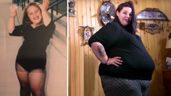 31 Weeks Pregnant & Morbidly Obese