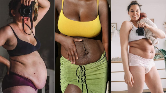 32 Stunning Photos That Show How Different Postpartum Bodies Can Look 32 Stunning Photos That Show How Different Postpartum Bodies Can Look