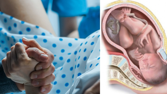 3 Major Ways to Prevent Vaginal Tearing During Birth