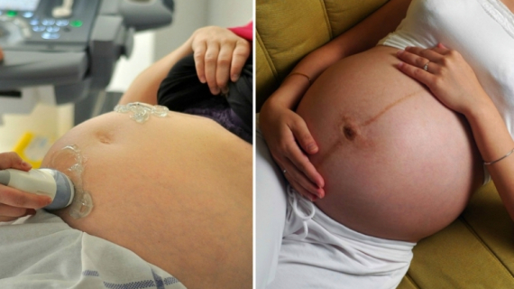 4 Pregnancy-Related Vaginal Infections: What You Need to Know