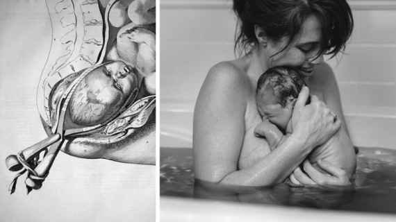 500 Years of Childbirth History