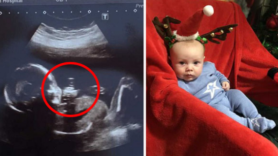 Mum Stunned To See ‘Cheeky Chappy’ Unborn Baby Giving Her The Finger In Scan Photo