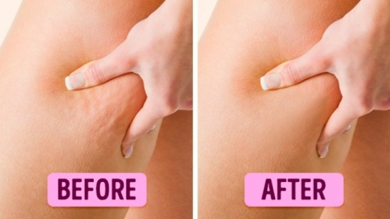 7 Effective Beauty Remedies You Can Make at Home