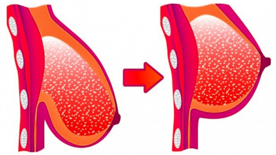 7 Super Effective Yoga Poses for Beautiful Breasts