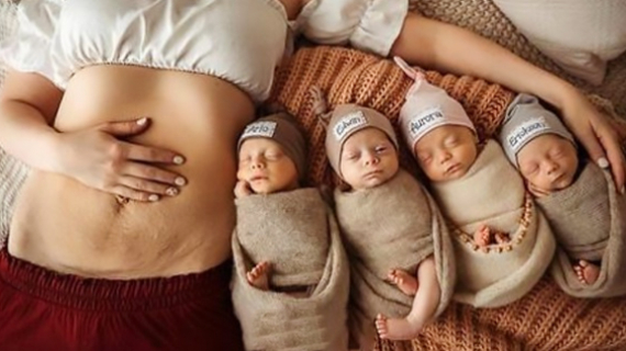 9 Of The Most Precious Photos Of Multiples