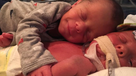 A Baby Twin Saying Final Goodbye To His Brother Will Break Your Heart