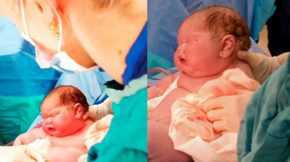 A Mother Has Given Birth To A Baby Boy 14Lb 15Oz Weighing More Than A Stone