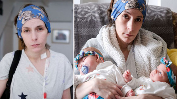 A Mum Who Hasn'T Been Able Tı Eat For A Decade Gives Birth To Miracle Twins