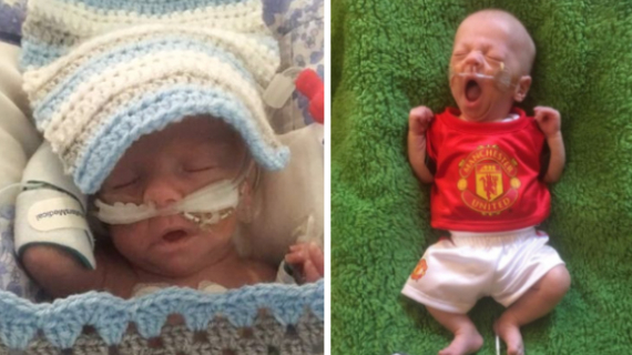 A Premature Baby Born 14 Weeks Early , He Wears A Teddy Bear Manchester United Kit