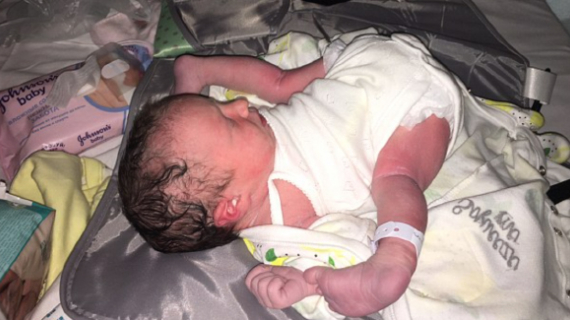 Baby Born Looking Like ‘Ready To Eat Counter Chicken’ With Her Legs Flung Forward And Feet Beside Her Shoulders