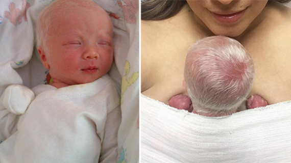 Baby Born With Striking White Hair And Mom Couldn’t Be Prouder