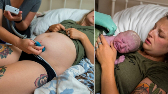 Incredible Photo: Baby Born with Eyes Open