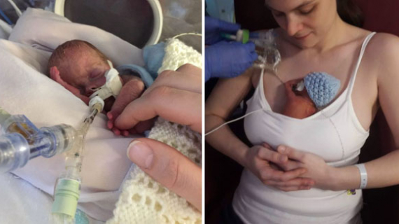 Baby Brought Back To Life In Sandwich Bag After His Heart Stopped For 40 Minutes