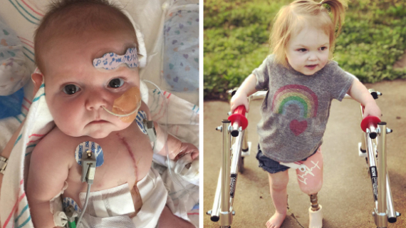 Baby Halle Spivey Survived After Her Heart stopped For 27 Minutes