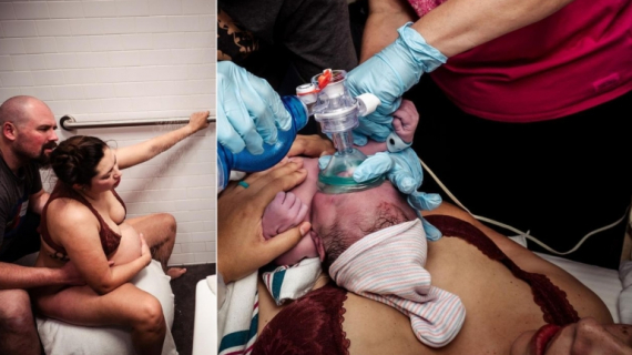 Childbirth is Wild: It Doesn’t Always Go As Planned