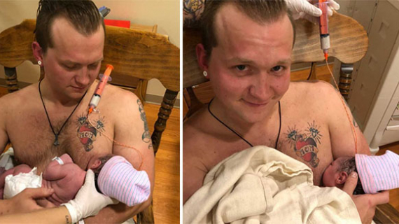 Dad Was First To Breast Feed The Baby