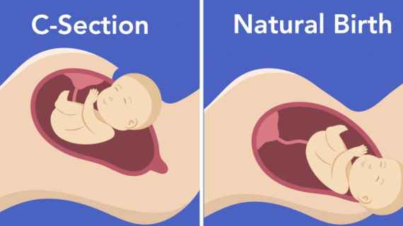 Doctors Answer Commonly Googled Pregnancy Myths