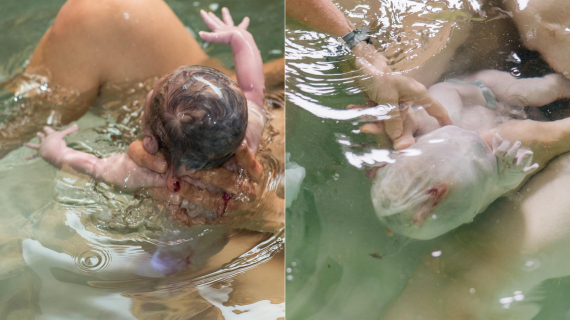 En Caul Waterbirth: 12 Beautiful Babies Born in Amniotic Sac
