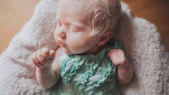 Everything On Her Is White, A Head Full Of Hair, White As Snow