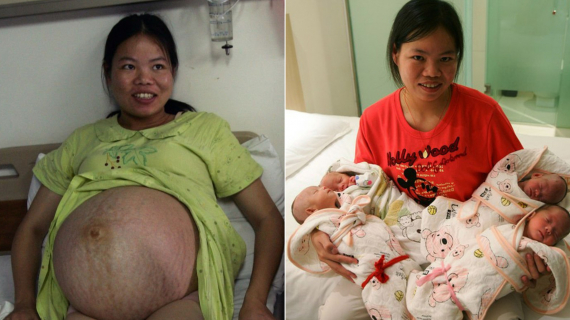 Farmer Woman Gives Birth to Quadruplets in China